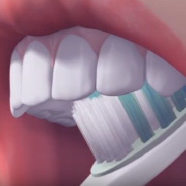 Video Igiene Orale