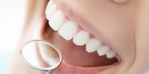 L'estetica del sorriso