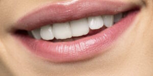 Perché le gengive si ritirano?