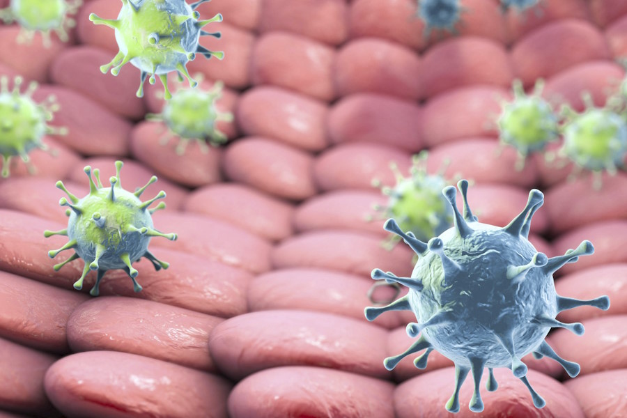 Virus SARS-CoV-2 e Stomatite