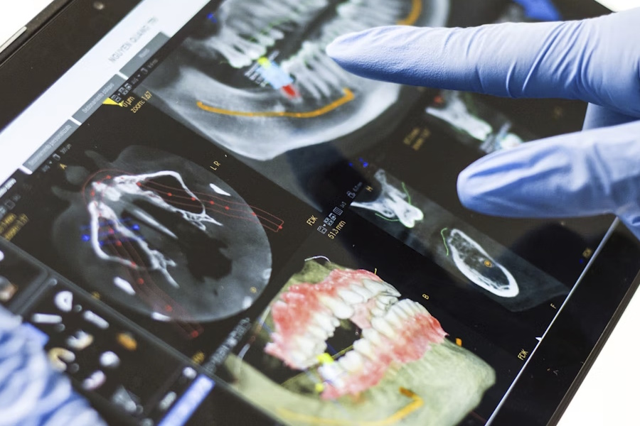 Come si svolge il Digital Check-up