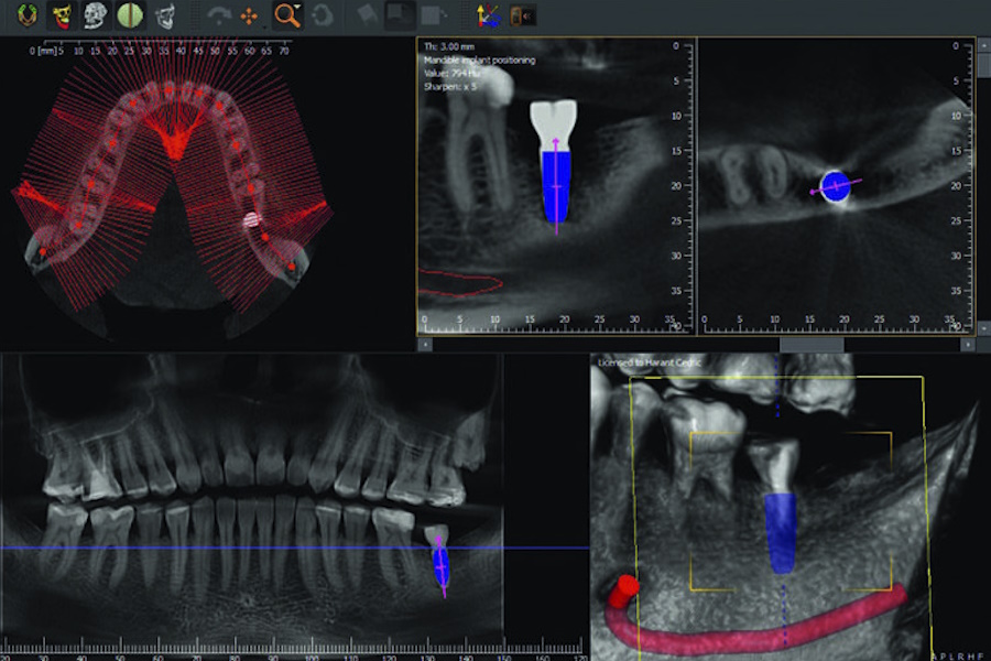 Digital Check-up: la nuova frontiera della diagnosi preventiva