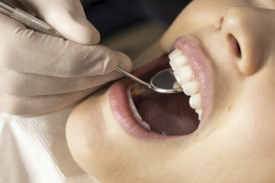 Perché l’igiene dentale è fondamentale