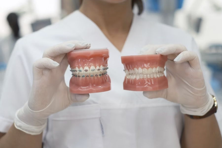 Le principali soluzioni ortodontiche