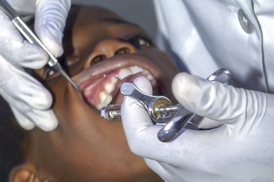 Le principali terapie pedodontiche