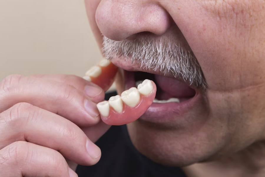 Protesi mobili dentali