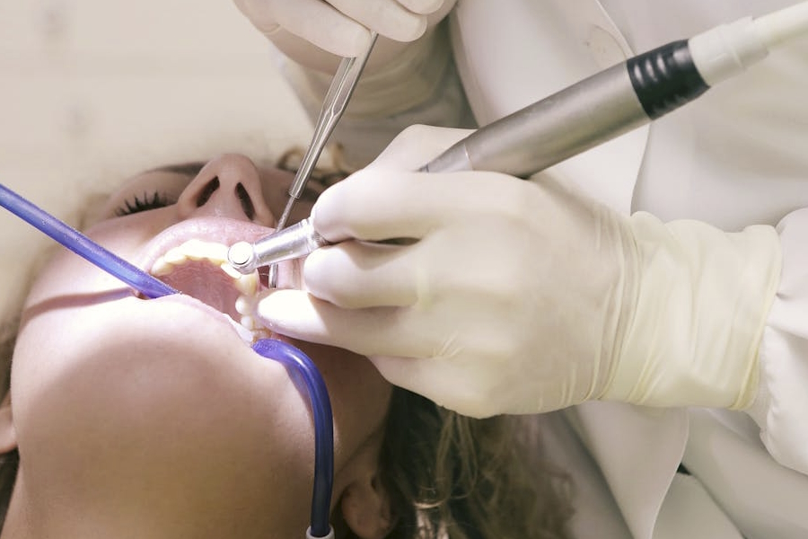 Faccette dentali: migliorare l'aspetto del sorriso