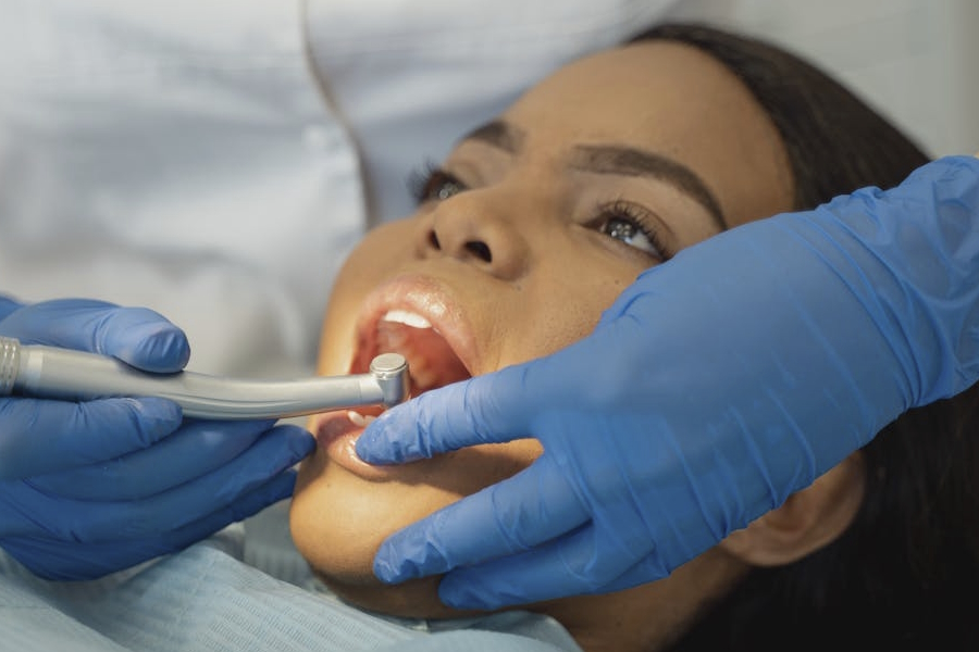 Faccette dentali: migliorare l'aspetto del sorriso