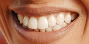 Soluzioni implantologiche per il sorriso