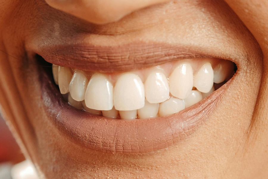 Soluzioni implantologiche per il sorriso