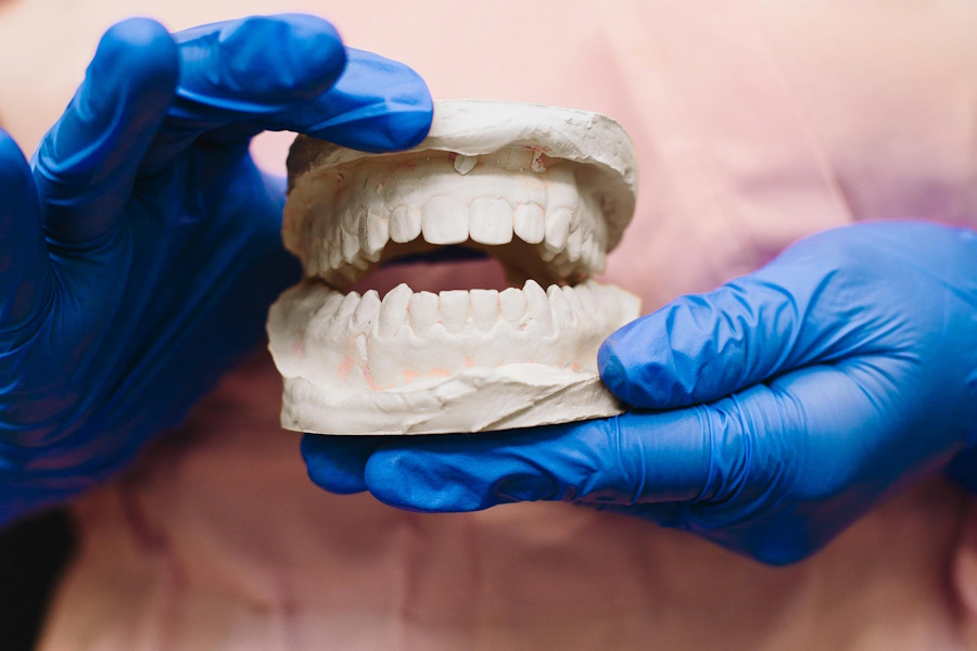 Soluzioni implantologiche per il sorriso