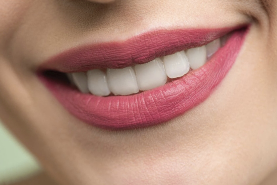 Trattamenti di sbiancamento dentale