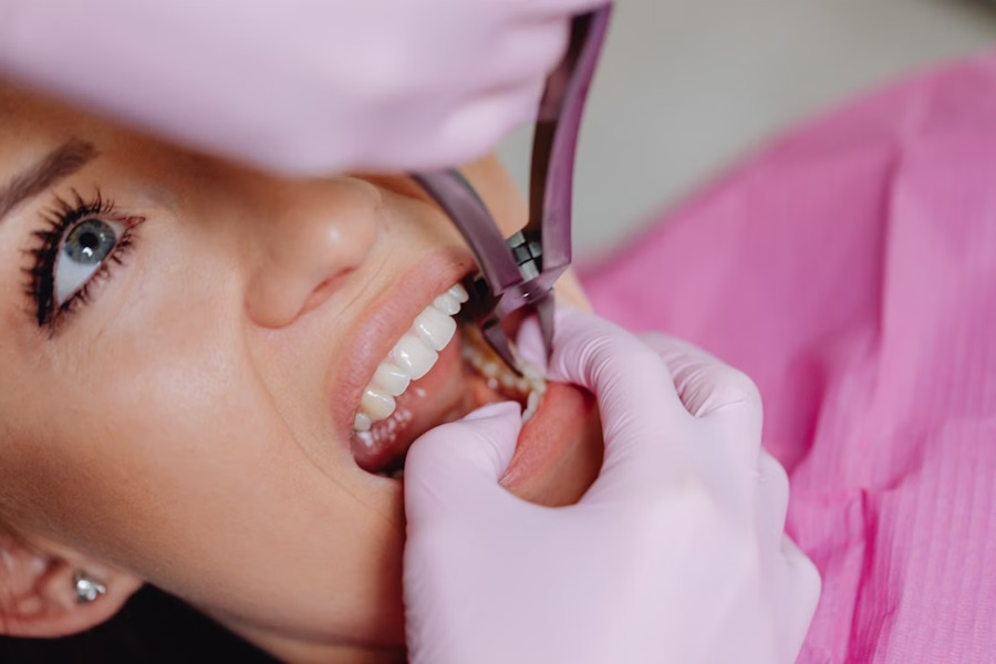 Dente del giudizio semincluso
