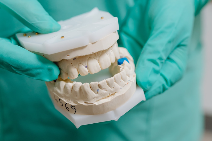 Sostituire un dente mancante