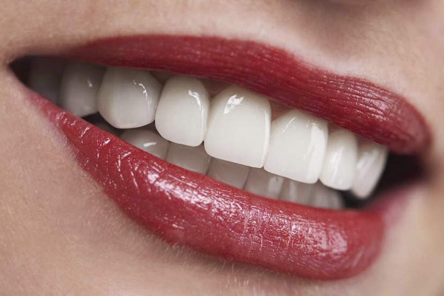 Gli impianti dentali All-on-four