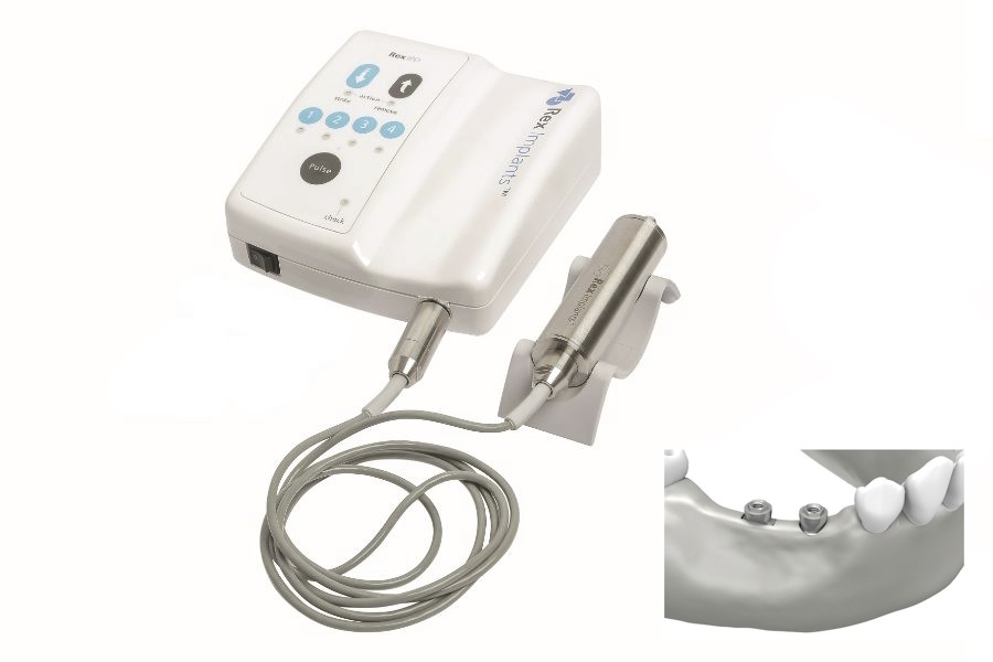 Le creste sottili sono un problema risolto