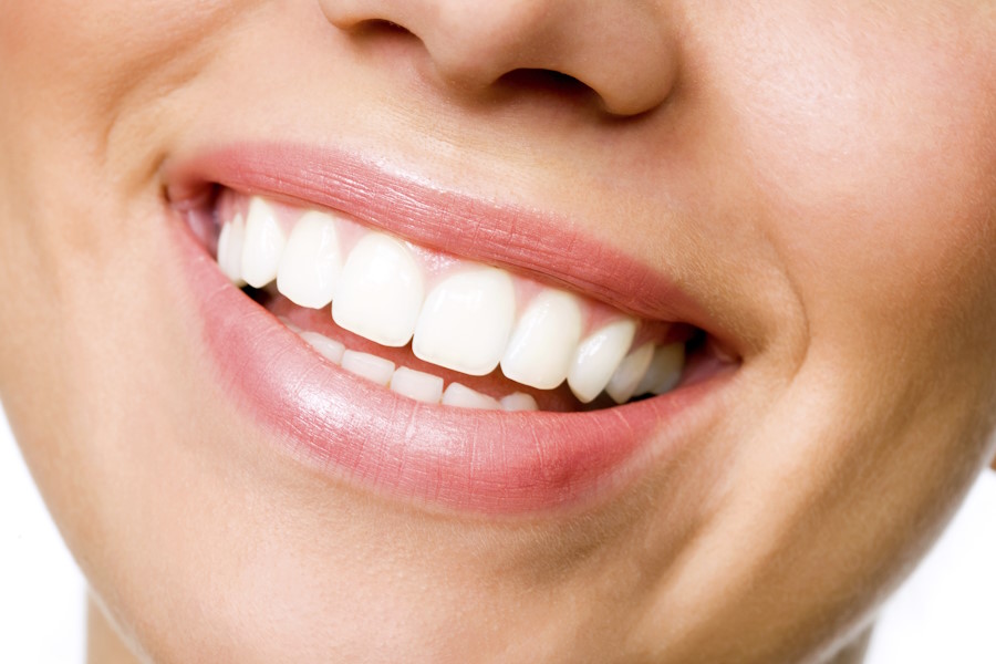 Denti bianchi