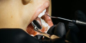 L’importanza dei controlli periodici dal dentista