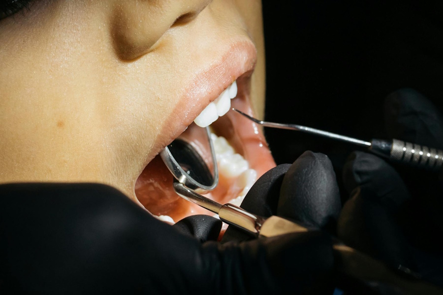 L’importanza dei controlli periodici dal dentista