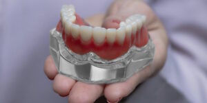 Le protesi mobili in nylon